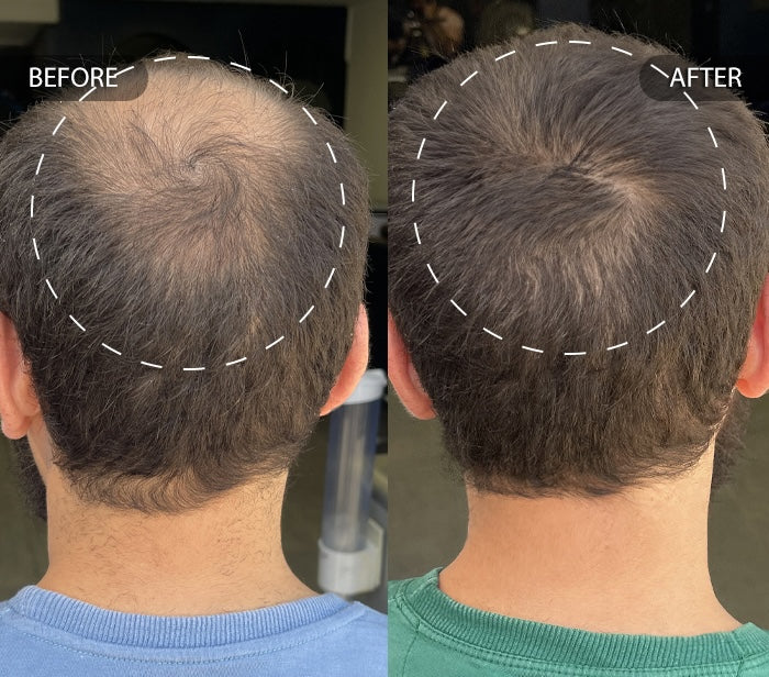 Before and after using magic drip on short brown hair increasing hair fullness