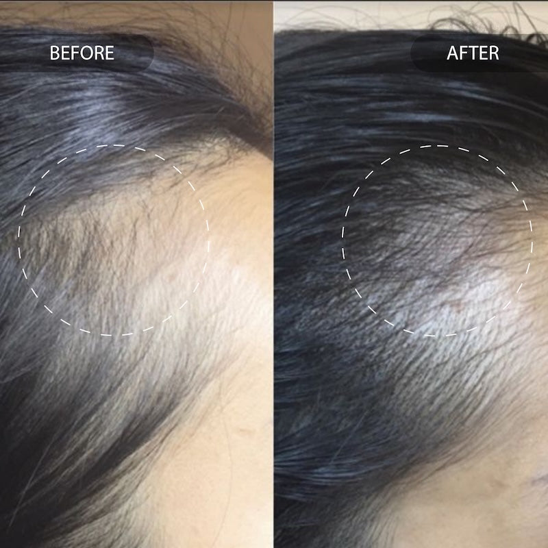 Before and after magic drip has been used to give black hair visible thickness and promotes new hair growth