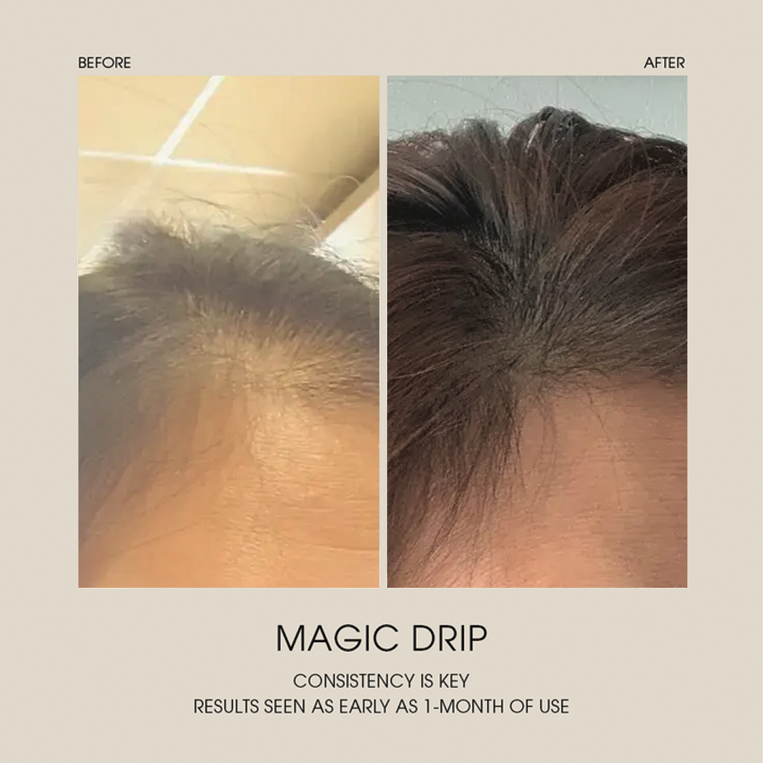 Magic Drip Hair Growth Serum