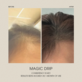 Magic Drip Hair Growth Serum