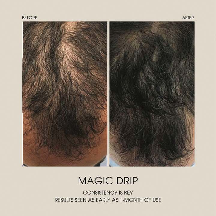 Magic Drip Hair Growth Serum