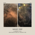 Magic Drip Hair Growth Serum
