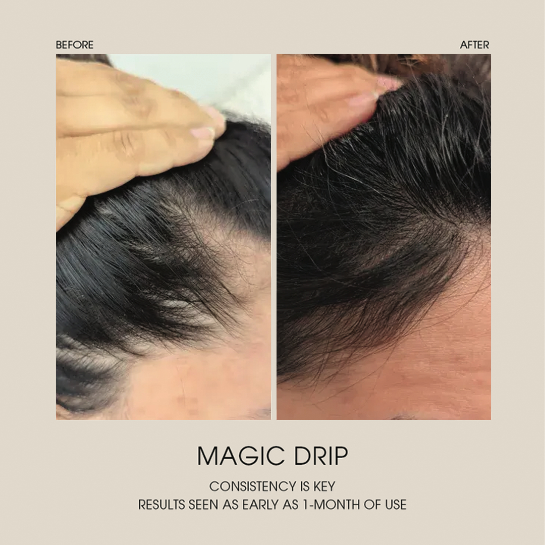 Magic Drip Hair Growth Serum