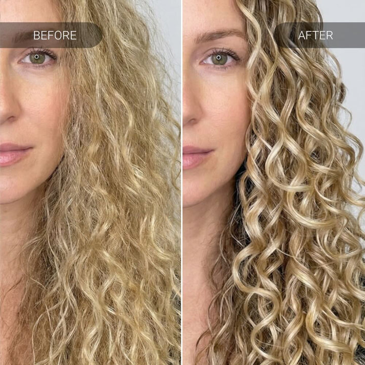 Gently Removes Buildup, Restores Scalp buildup