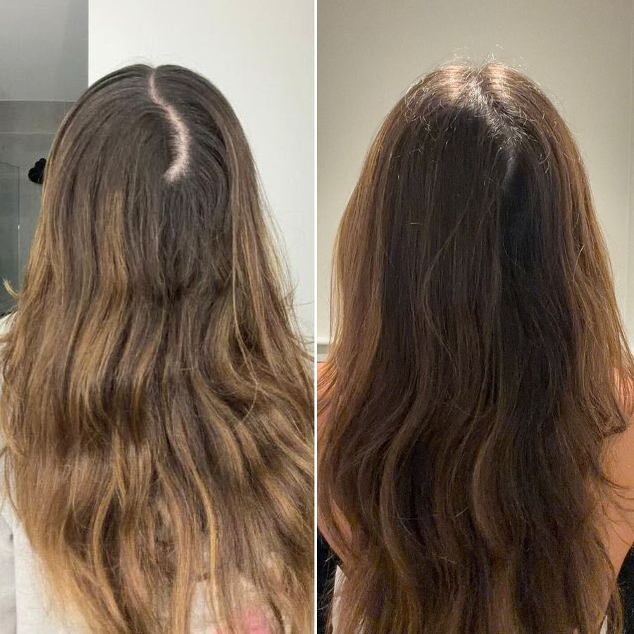 Part line before and after Magic Drip