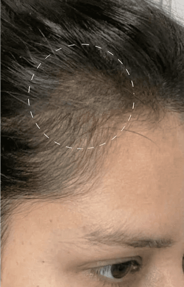 Magic Drip · Thinning + Fine Hair after